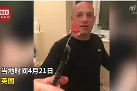 疫情期间无法就医 英国男子绝望用钳子拔牙折磨一个半小时图片