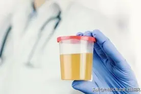 碱化尿液还有这两种好处？千万别大意了图片