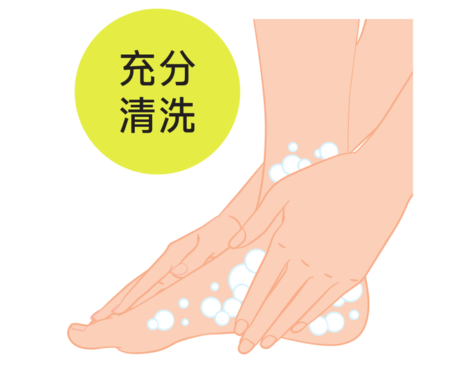 角化过度型足癣脂肪肝