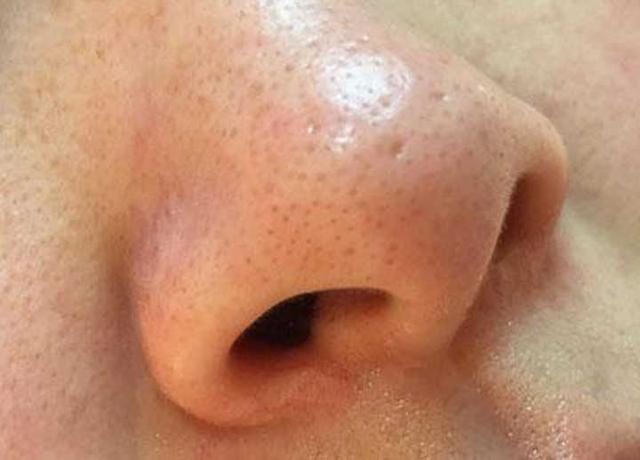 杩欎簺娓╁拰姘ㄥ熀閰告礂闈㈠ザ鏄嚭浜嗗悕鐨勫ソ锛屾俯鍜屼笉鍒烘縺锛岄€傜敤浜庡绉嶈偆璐? onerror=