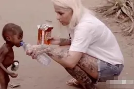 “皮包骨男孩”：6年前在非洲被女游客收养，现状如何？图片