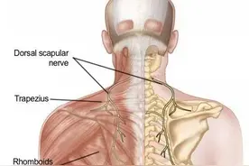 颈肩痛不只是颈椎病，小心肩胛背神经卡压症图片