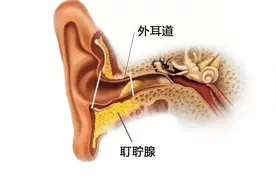 耳屎到底要不要掏？这个困扰了十多年的问题终于有答案了图片