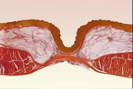 肚脐的黑泥不能清理，否则会进风、漏气、烂肠子？医生辟谣说清楚图片