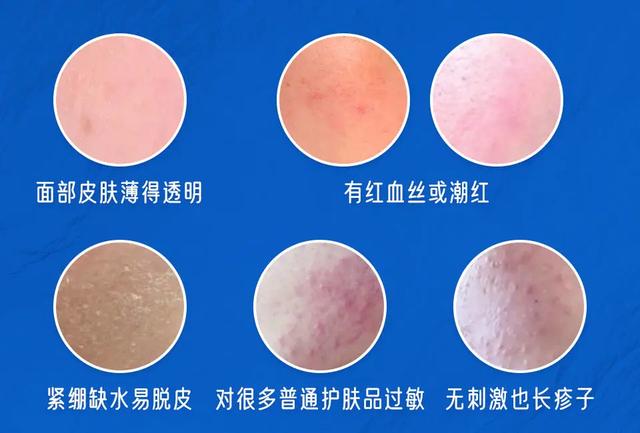 90%的皮肤问题是「作」出来的，快来看看你中招了没？