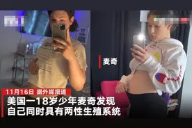 美国18岁少年怀孕4个月：具有两性生殖器，决定生下孩子再做手术图片