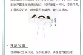 漫画告诉你6个口腔治疗的术后注意事项图片