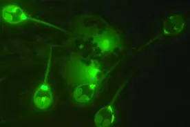科学家刚发现一种动物，长着外星人似的眼睛，不会呼吸，没有肌肉图片