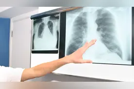 肺结节是良性还是恶性？体检发现肺结节怎么办？一招教你分辨图片