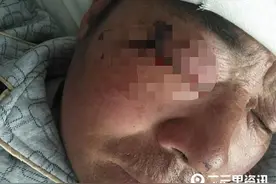 榆林一村级防疫员打针时被牛踢伤致右眼失明图片