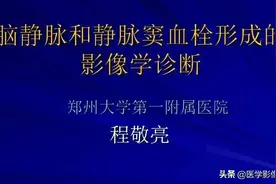 脑静脉和静脉窦解剖及血栓形成的影像学诊断图片
