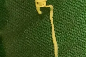 各位，告诉一下你10cm的虫子在大脑里穿梭是什么样的体验图片