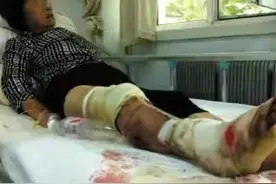 注意！四川毒蛇连续咬伤人，野钓预防毒蛇与自救，你会吗？图片