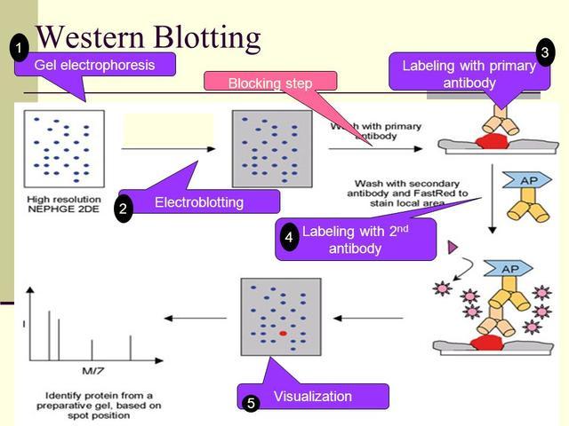 生物科研狗必备技能之~Western Blot