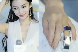 综艺节目有多危险：杨颖手指骨折，宋小宝反复腰伤，沈腾吃到马粪图片