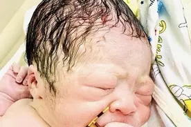 外媒：越南婴儿出生时手抓节育环，强大生命力让母亲节育失败图片
