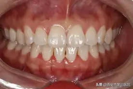 【“科技之春”之三院讲堂】牙齿美白有妙招图片