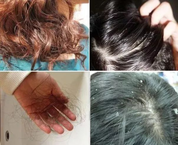 不油腻只闪亮，迷人秀发就靠氨基酸洗发水