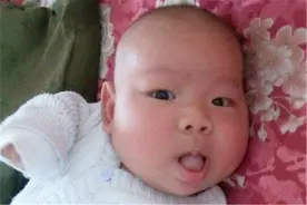 宝宝总爱吐舌头，除模仿玩耍之外，还有几种病理因素要重视图片