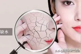 【相约春暖花开时，许您白嫩婴儿肌】市三院皮肤科德玛莎家族新品Ⅱ代水光机到货啦，爱美哒女神约起来图片