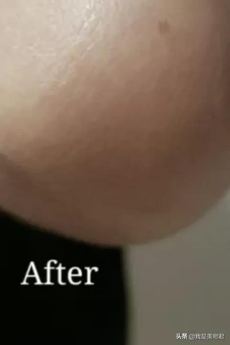 强生润肤乳过期了能涂身体吗