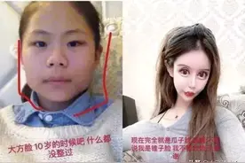16岁女孩整容成瘾，前后整容60次花了400多万，已无医生敢接单图片