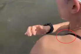 还能比赛吗？我国运动员在东京湾训练后，身上爬满了小虫图片