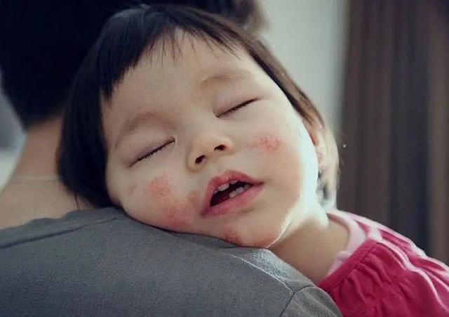 郴州“大头娃娃”事件再解析：不只倍氨敏，这些产品也可能有害