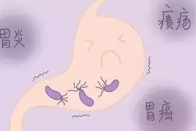 健康生活丨萎缩性胃炎的来龙去脉（二）图片