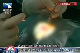 担心的事还是发生了！你还敢边走路边玩手机吗？图片