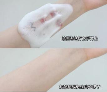 皮肤科医生提醒：原来我的“洗脸”方式一直是错的…细思极恐