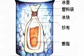 救救孩子！三岁幼儿断指历险记图片