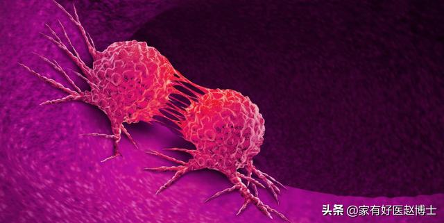 四种“高致癌性”炎症并不少见，降低患癌风险从预防和早诊做起