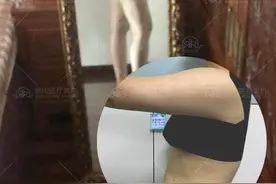 美呆！上身臃肿没气质 吸脂后显瘦变时髦girl图片