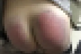 女孩未完成作业屁股遭打开花至住院，父亲：老师说不知板子有齿，只打五六下图片