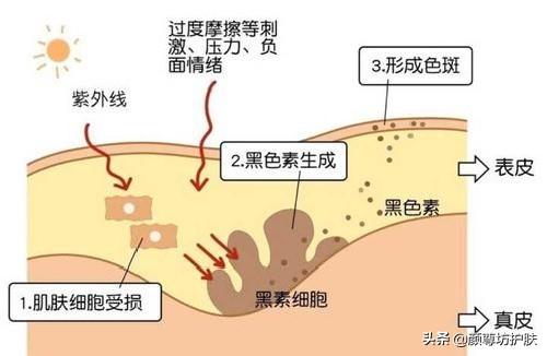 脸部出现了这些症状，说明你需要给脸部排个毒了