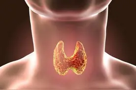 【科普系列】甲状腺疾病发现与诊治图片