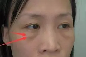 女人有眼袋比同龄人显老十岁，教你几招，不出7天眼部紧致图片