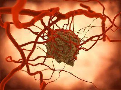 蛋白质如何提高免疫力？如何补充足够蛋白质？