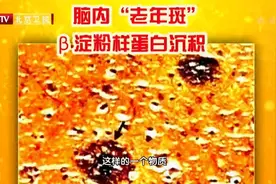 这些事会让大脑堆满“垃圾”，引发老年痴呆！三招“清扫”法，还你“干净”大脑图片