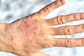 民间良方-生姜酒图片