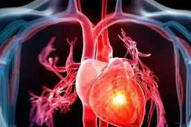 “心痛”真的是心脏疼吗？图片