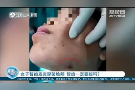 扬州女子智齿发炎硬扛好几年，左侧脸颊被脓肿穿破 智齿一定要拔吗？图片