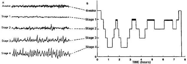 正在梦游的人，真的不能叫醒吗？