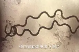 带你了解一下什么是梅毒图片