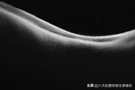 为什么现在女性越来越重视私密保养与整形了？图片