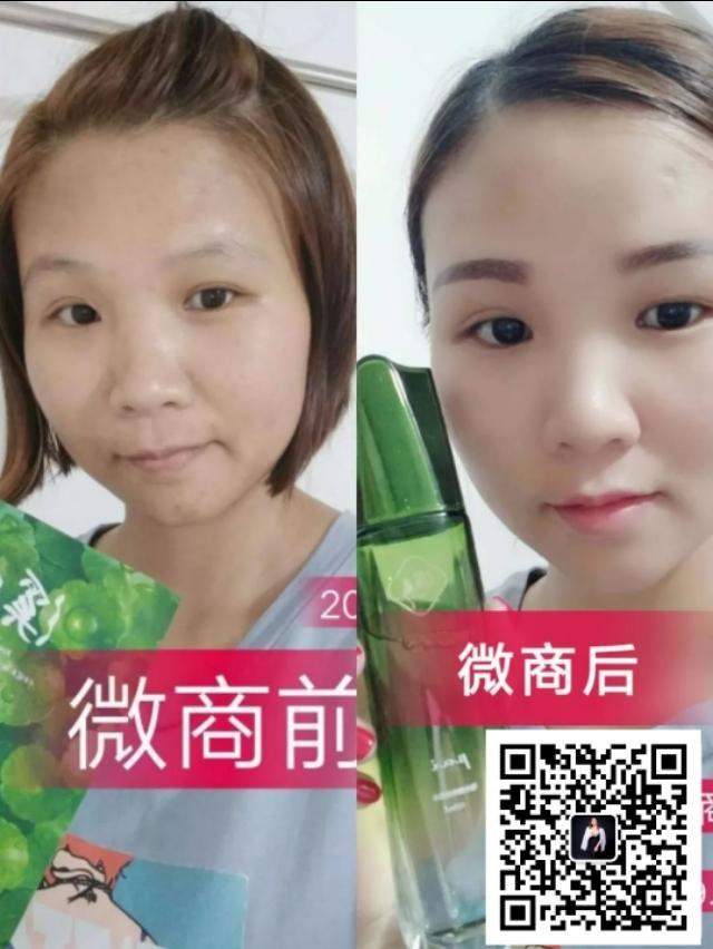 溪秀面膜怎么代理？溪秀护肤品，溪秀治愈痘痘肌的劲爆反馈