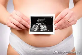 做试管婴儿为什么建议选择单胚胎移植？图片