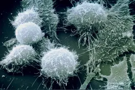 她去世70年了，身体的癌细胞却还活着，总质量已经超过5000万吨图片