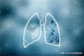 肺结节随访只能做胸部CT？医生：你错了！抗炎复查了解一下图片